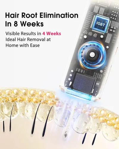 Epilator IPL definitiv PB2, cu răcire